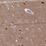 IRGQ Antibody in Immunohistochemistry (IHC)