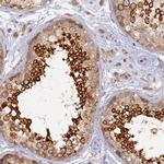 WDR62 Antibody in Immunohistochemistry (Paraffin) (IHC (P))