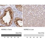 WDR62 Antibody in Immunohistochemistry (IHC)