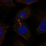 WDR62 Polyclonal Antibody