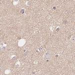 WDR54 Antibody in Immunohistochemistry (IHC)