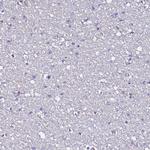 POTEE Antibody in Immunohistochemistry (Paraffin) (IHC (P))