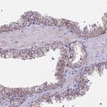 POTEE Antibody in Immunohistochemistry (Paraffin) (IHC (P))