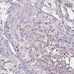 POTEE Polyclonal Antibody