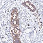POTEE Antibody in Immunohistochemistry (IHC)