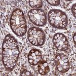 PPP1R11 Antibody in Immunohistochemistry (Paraffin) (IHC (P))