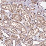 PPP1R11 Antibody in Immunohistochemistry (Paraffin) (IHC (P))