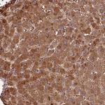 PPP1R11 Antibody in Immunohistochemistry (Paraffin) (IHC (P))