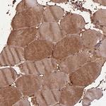 PPP1R11 Antibody in Immunohistochemistry (Paraffin) (IHC (P))