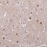 FAM108A1 Antibody in Immunohistochemistry (Paraffin) (IHC (P))