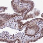 FAM108A1 Antibody in Immunohistochemistry (Paraffin) (IHC (P))