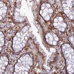FAM108A1 Antibody in Immunohistochemistry (Paraffin) (IHC (P))