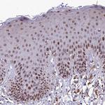 FAM108A1 Polyclonal Antibody