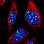 MPND Polyclonal Antibody