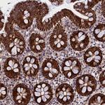 MPND Antibody in Immunohistochemistry (Paraffin) (IHC (P))