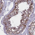 FAM129C Antibody in Immunohistochemistry (Paraffin) (IHC (P))