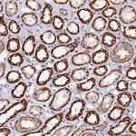 C19orf24 Antibody in Immunohistochemistry (Paraffin) (IHC (P))