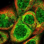 C19orf24 Polyclonal Antibody