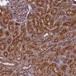 ENTH Antibody in Immunohistochemistry (Paraffin) (IHC (P))
