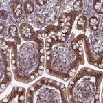 ENTH Antibody in Immunohistochemistry (Paraffin) (IHC (P))