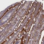 SCAMP4 Antibody in Immunohistochemistry (Paraffin) (IHC (P))