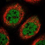 CABIN1 Polyclonal Antibody