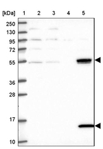 UFSP2 Antibody in Western Blot (WB)