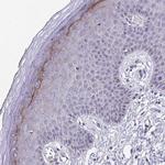 BPIL2 Polyclonal Antibody