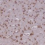 JMY Antibody in Immunohistochemistry (Paraffin) (IHC (P))
