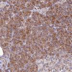 JMY Polyclonal Antibody