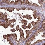 JMY Antibody in Immunohistochemistry (Paraffin) (IHC (P))