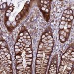 JMY Antibody in Immunohistochemistry (Paraffin) (IHC (P))