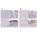 UPK2 Polyclonal Antibody
