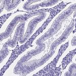 UPK2 Antibody in Immunohistochemistry (IHC)