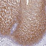 RHCG Antibody in Immunohistochemistry (IHC)