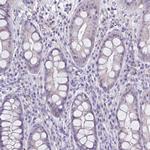 RHCG Antibody in Immunohistochemistry (IHC)