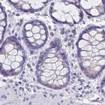RHCG Antibody in Immunohistochemistry (IHC)