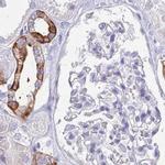RHCG Antibody in Immunohistochemistry (IHC)