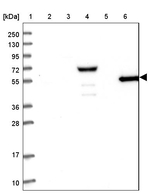 RHCG Antibody in Western Blot (WB)