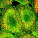 CCDC97 Polyclonal Antibody