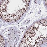 CCDC97 Antibody in Immunohistochemistry (Paraffin) (IHC (P))