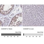 CCDC97 Antibody in Immunohistochemistry (IHC)