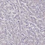 CCDC97 Antibody in Immunohistochemistry (IHC)