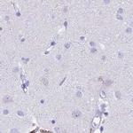 SNTN Antibody in Immunohistochemistry (IHC)