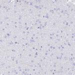 TRIM10 Antibody in Immunohistochemistry (Paraffin) (IHC (P))