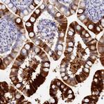 TRIM10 Antibody in Immunohistochemistry (Paraffin) (IHC (P))