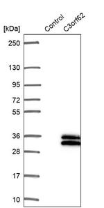 C3orf62 Antibody in Western Blot (WB)