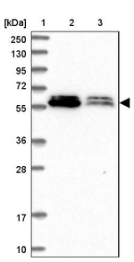 ALG10 Antibody in Western Blot (WB)