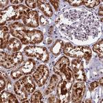 CMC1 Polyclonal Antibody