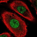 TMEM255B Polyclonal Antibody